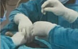 मिनिमल इनवेसिव सर्जरी करके डॉक्टर अनुपम सचान ने रचा इतिहास