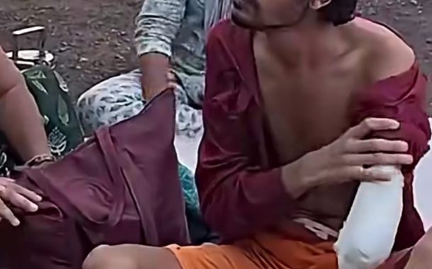 गलत ड्रिप के कारण हाथ कटवाना पड़ा